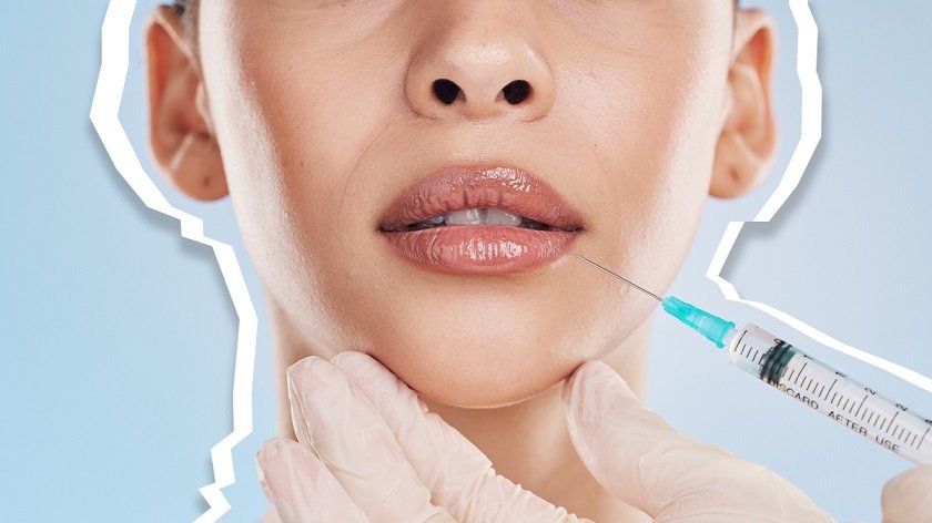 Best Lip Filler Treatments Near Me